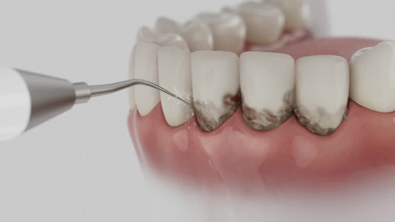 Reliable Dental Implants contractor in Coosada, AL by Smile Center Dentistry